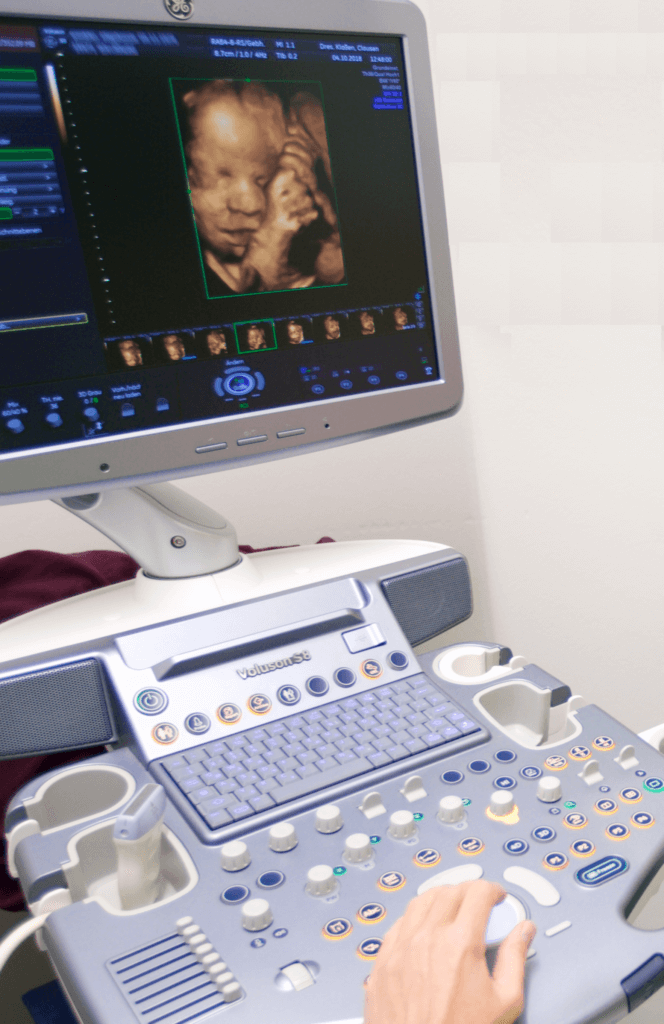3D Ultraschallaufnahme Embryo